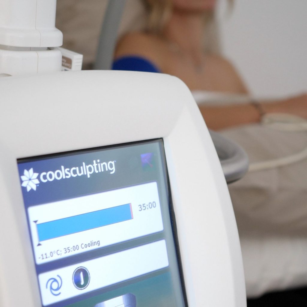 CoolSculpting Methode